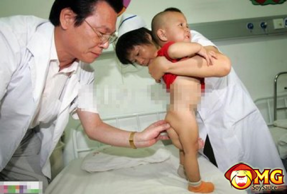 3-3-legged-chinese-asian-boy-kid1.jpg