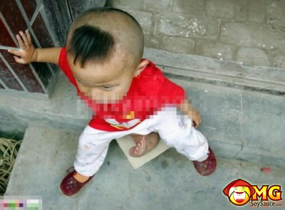 3-legged-chinese-asian-boy-kid1.jpg