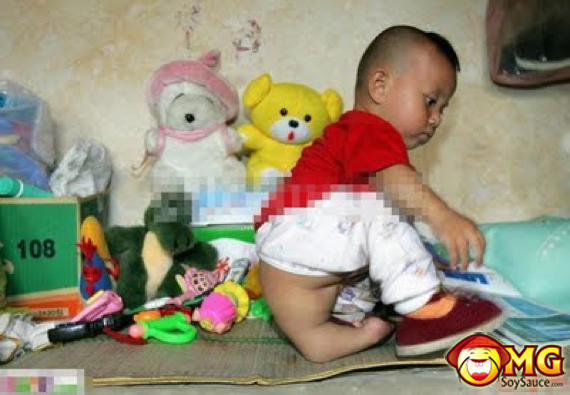 4-3-legged-chinese-asian-boy-kid1.jpg